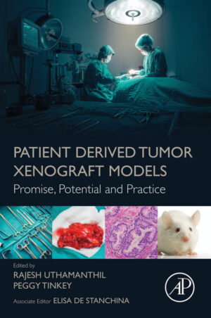 patient derived tumor xenograft models promise potential a.jpg